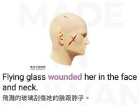 hurt的意思(怎么用它来表达)