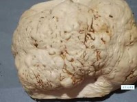 树瘤是什么意思？原来它有这些不为人知的秘密！