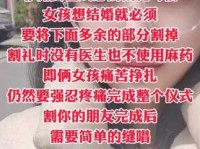 割礼节什么意思？通过全方位解析带你认识异域文化！