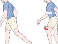 “步态蹒跚”是什么意思？一文读懂蹒跚步态的含义