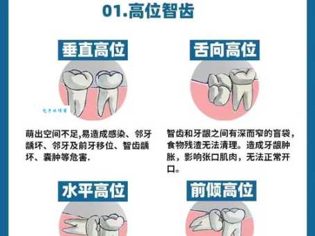 齿是什么意思