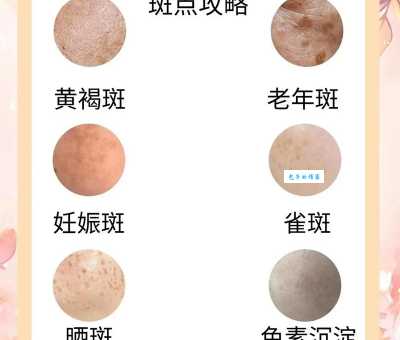 斑是什么意思