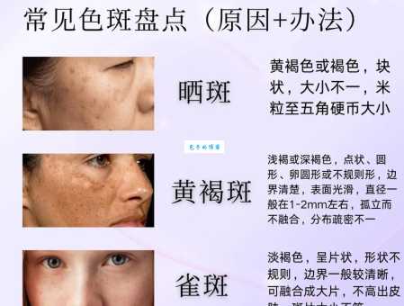斑是什么意思