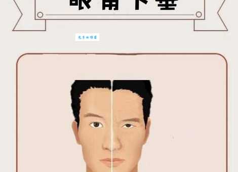 窝囊相