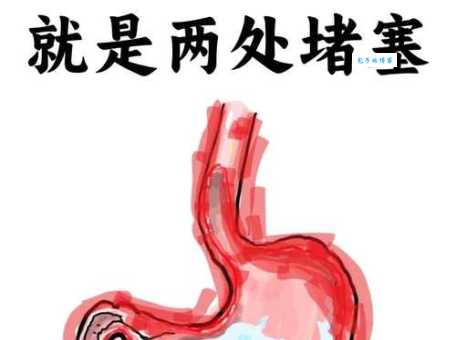 翻肠倒肚是什么意思中医解释这种症状的由来