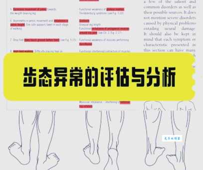 步态蹒跚什么意思啊 中老年人常见的走路问题解析