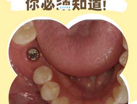 牙商是什么意思？深度解析历史上的牙商！