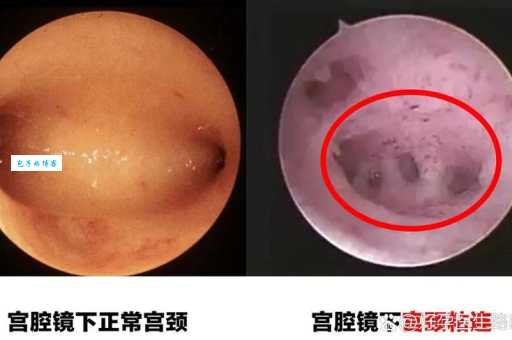 黏皮着骨是什么意思?一分钟帮你彻底搞懂!