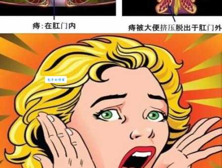 原来挂丝是这个意思！看完你就懂了！