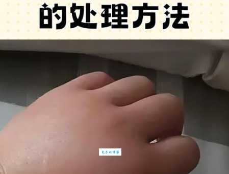 局部肿胀是什么意思？是不是发炎了怎么处理？